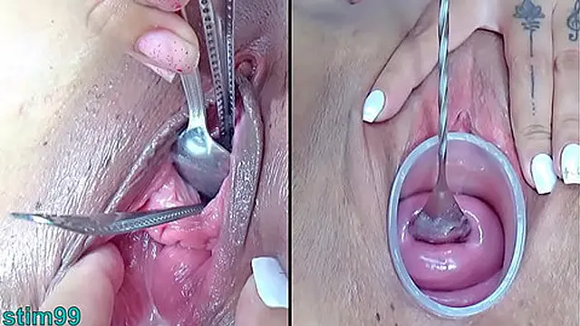 Hot Milf Lesbians Explore Intimate Cervix and Urethral Play