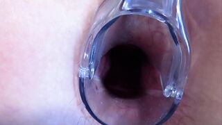 Deep penetration and exploration with a speculum as she spreads her holes wide